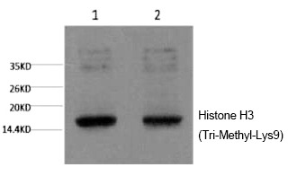 Anti-Tri-methyl-HIST1H3A (Lys9) Antibody (5G768)