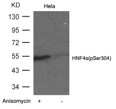 Anti-Phospho-HNF4A (Ser304) Polyclonal Antibody