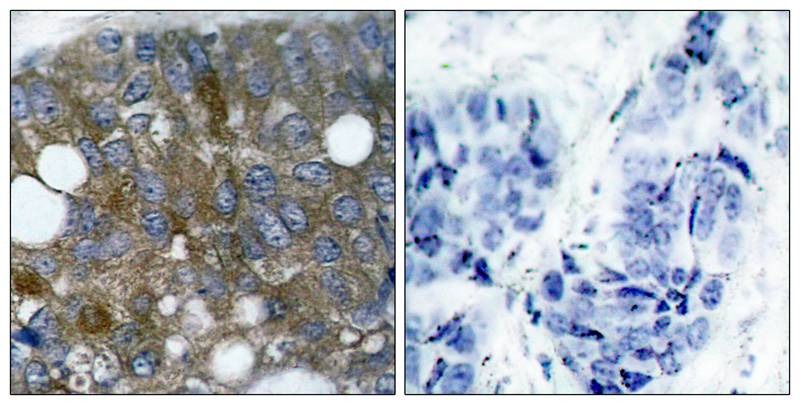 Anti-Phospho-Hsp27/HSPB1 (Ser15) Polyclonal Antibody