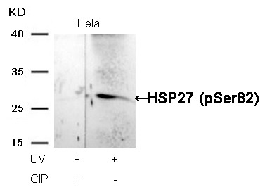 Anti-Phospho-Hsp27/HSPB1 (Ser82) Polyclonal Antibody