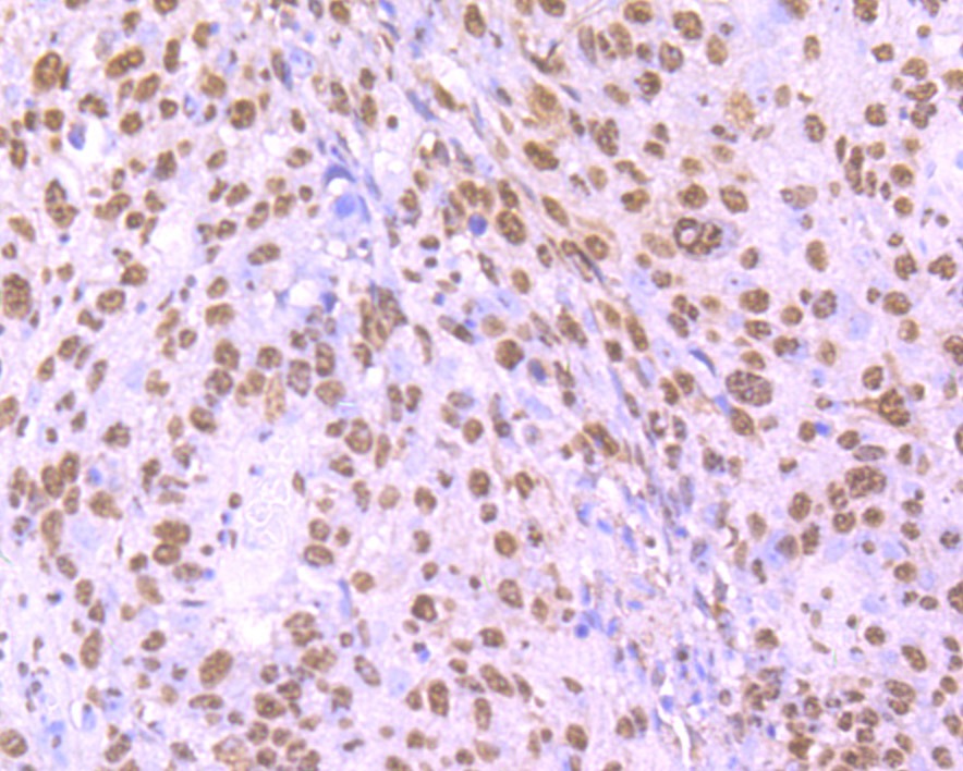 Anti-HNRNPU Antibody (9L701)