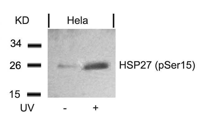 Anti-Phospho-Hsp27/HSPB1 (Ser15) Polyclonal Antibody