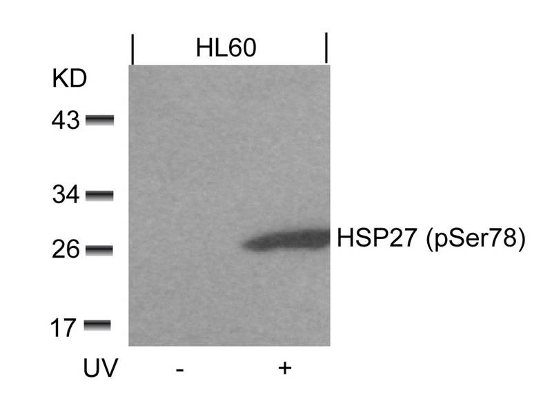 Anti-Phospho-Hsp27/HSPB1 (Ser78) Polyclonal Antibody