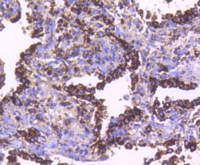 Anti-HSPD1 Antibody (4J857)