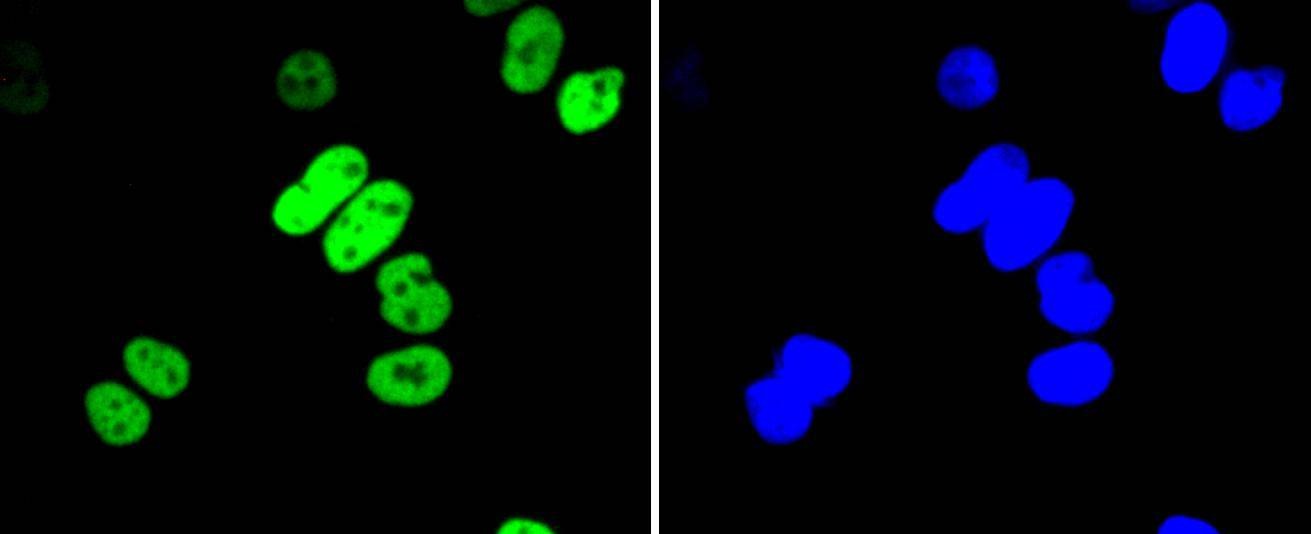 Anti-Acetyl-HIST1H3A (Lys56) Antibody (4S839)
