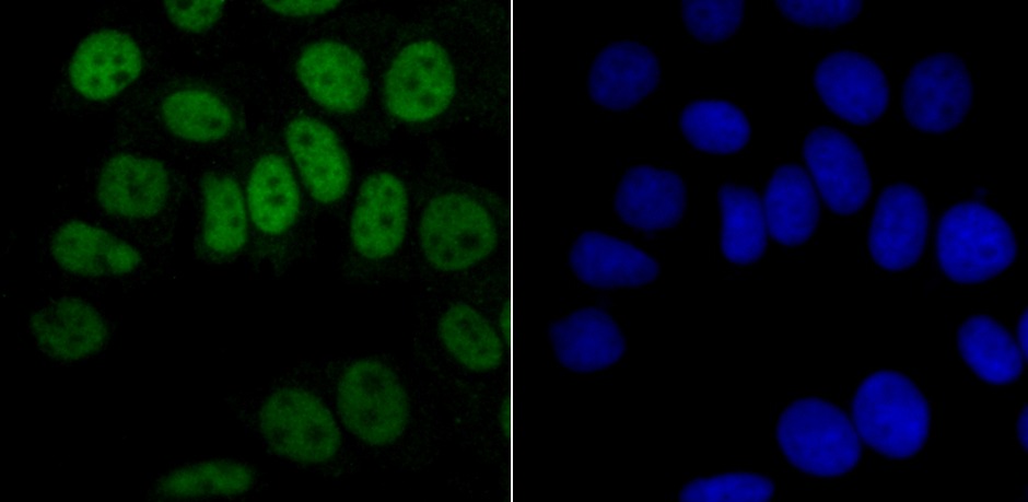 Anti-HNRNPA1 Antibody (4Q19)