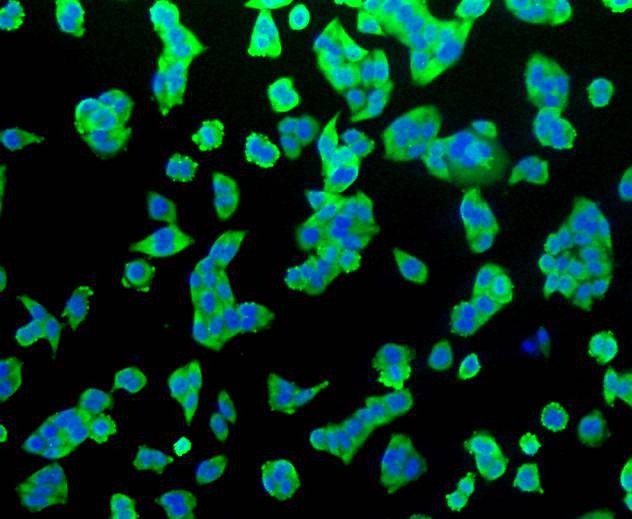 Anti-HSP70 Antibody (7N158)