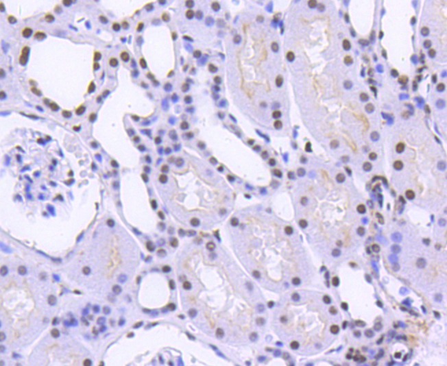 Anti-HNRNPC Antibody (2T80)