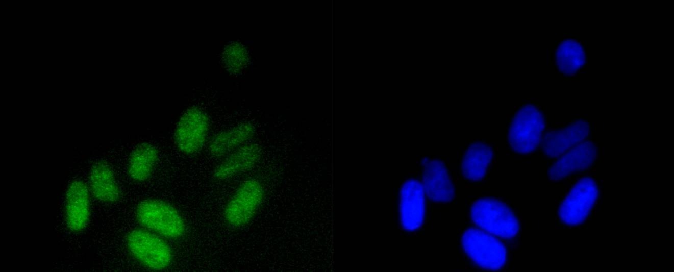 Anti-Mono-methyl-HIST1H3A (Lys18) Antibody (6Y799)