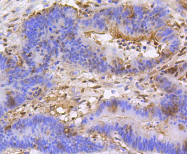 Anti-Mono/Di-methyl-HIST1H3A (Lys79) Antibody (2D87)