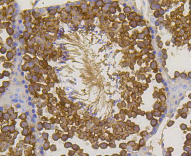 Anti-HSP70 Antibody (7N158)