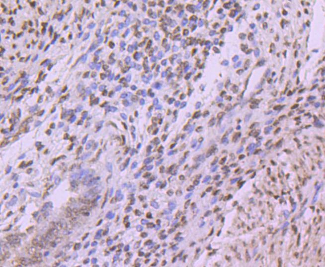 Anti-HIST1H3A Antibody (9H443)