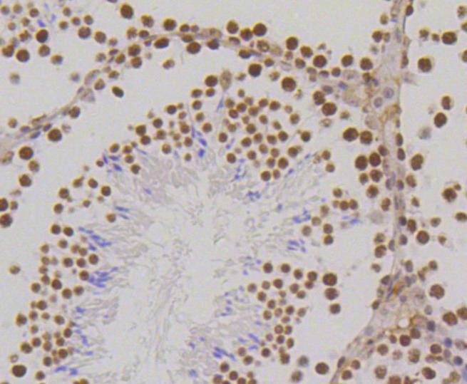 Anti-Mono-methyl-HIST1H3A (Lys18) Antibody (6Y799)