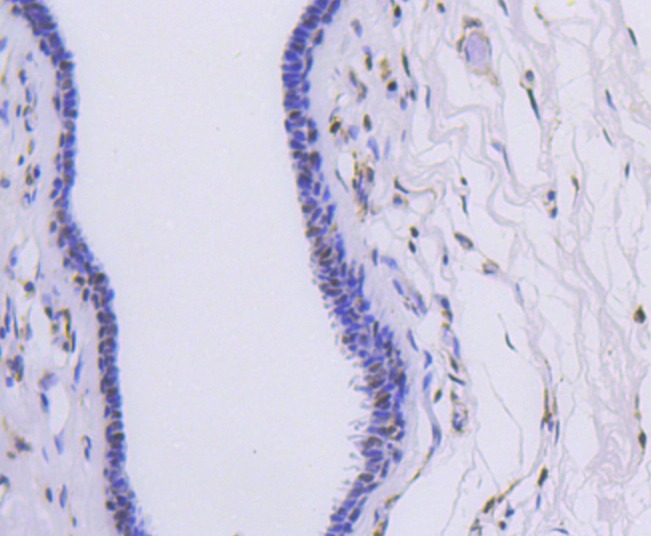 Anti-HNRNPC Antibody (2T80)