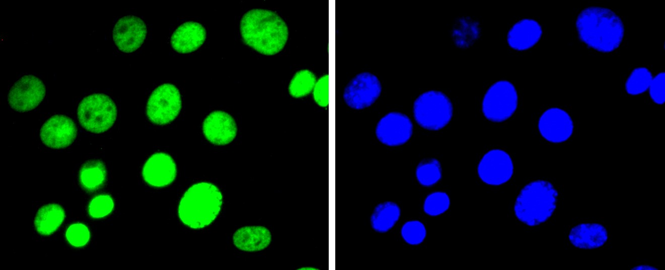 Anti-Di-methyl-HIST1H3A (Lys9) Antibody (6Y164)