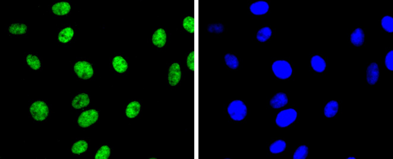 Anti-Di-methyl-HIST1H3A (Lys9) Antibody (6Y164)