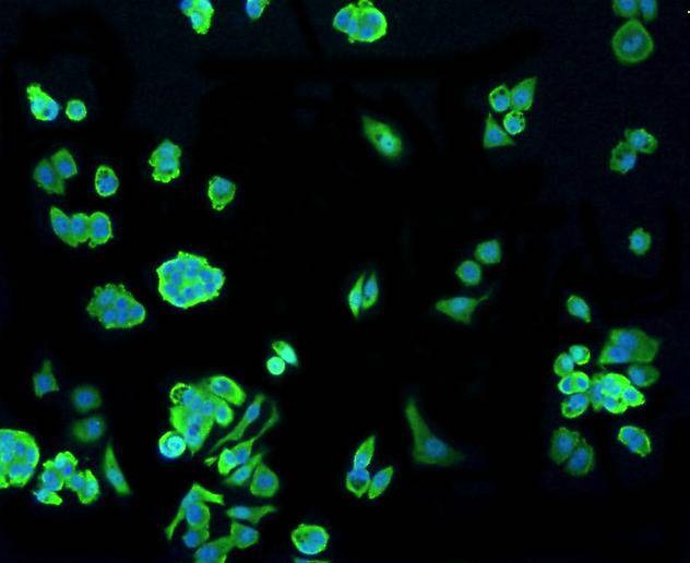 Anti-HSP70 Antibody (7N158)