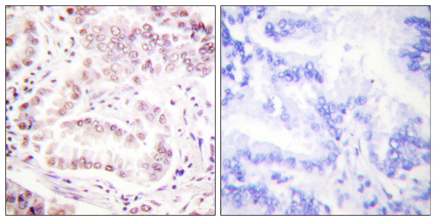Anti-Acetyl-HIST1H3A (Lys27) Polyclonal Antibody