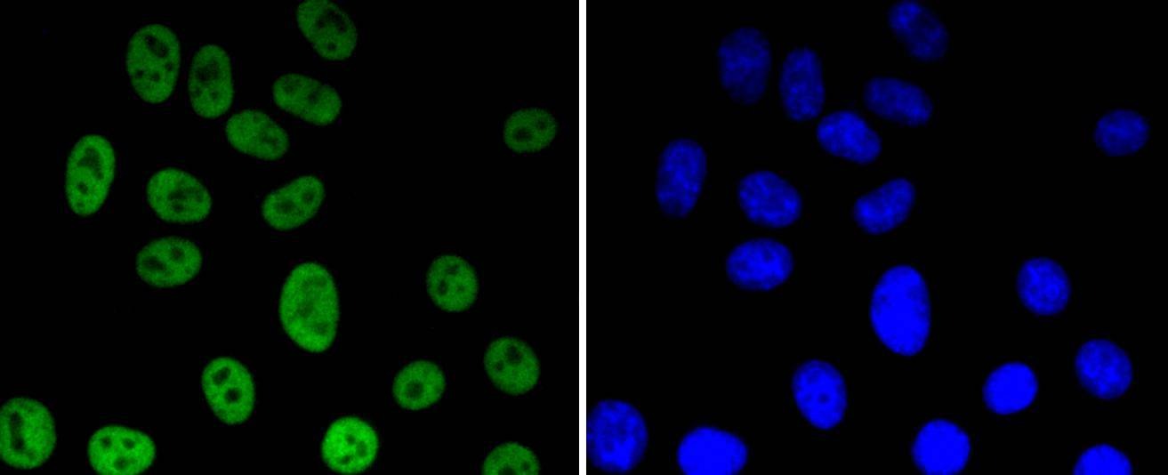 Anti-Acetyl-HIST1H3A (Lys56) Antibody (4S839)