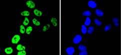 Anti-HNRNPC Antibody (2T80)