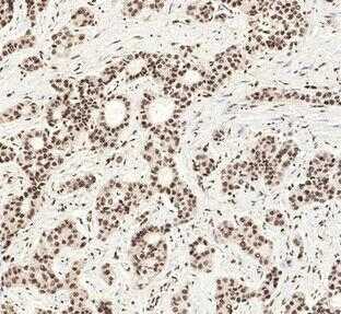 Anti-Acetyl-HIST1H3A (Lys9) Polyclonal Antibody
