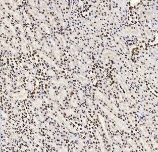 Anti-Acetyl-HIST1H3A (Lys9) Polyclonal Antibody
