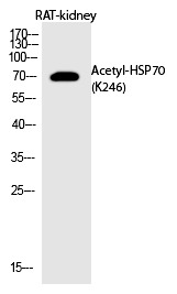 Anti-Acetyl-HSP70 (Lys246) Polyclonal Antibody