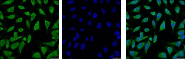Anti-HSP70 Antibody (4V228)