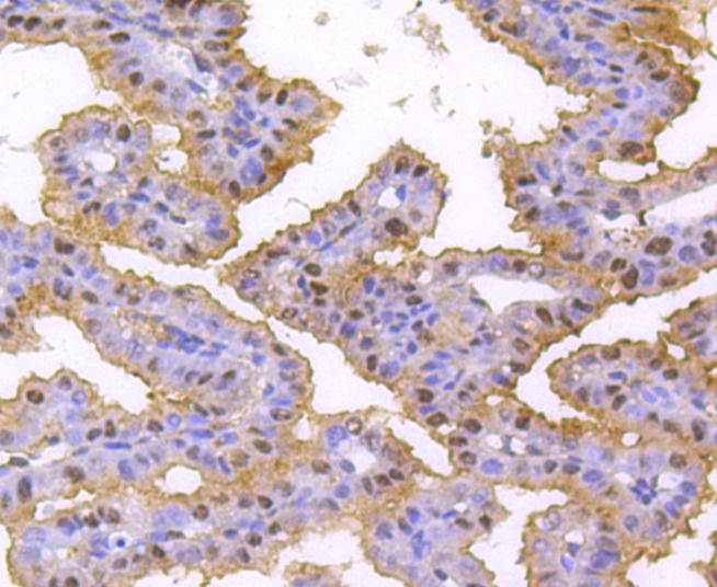 Anti-HNRNPC Antibody (2T80)