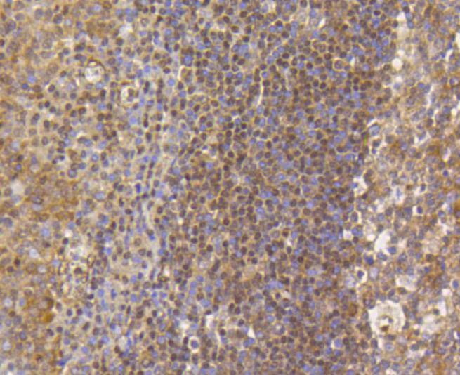 Anti-Mono/Di-methyl-HIST1H3A (Lys79) Antibody (2D87)