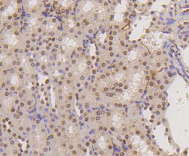Anti-Mono-methyl-HIST1H3A (Lys18) Antibody (6Y799)