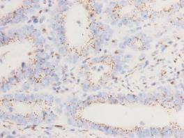 Anti-Golgin subfamily A member 5 Antibody (2L722)