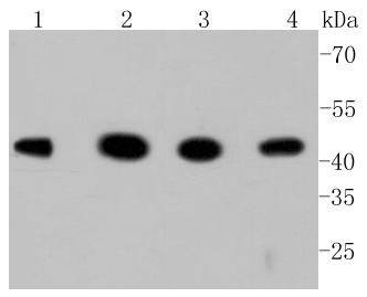 Anti-GSK3B Antibody (1A830)