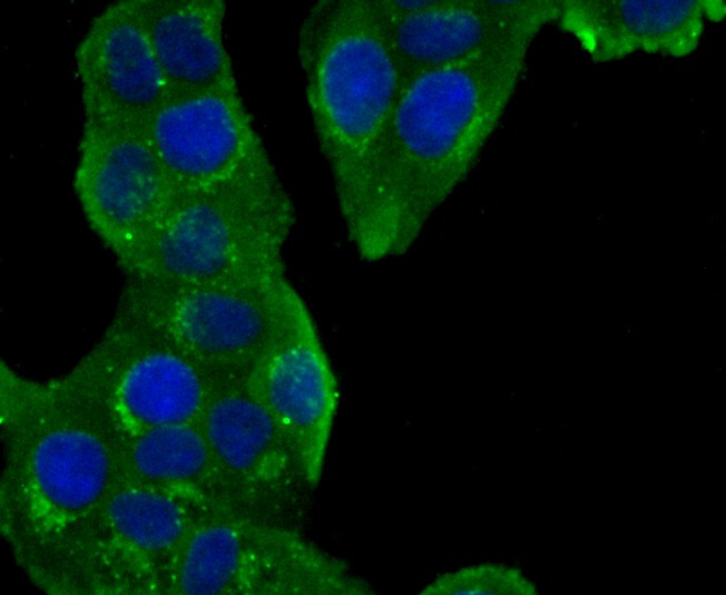 Anti-GOLM1 Antibody (8V618)