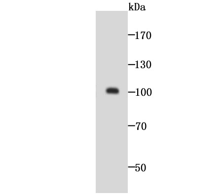 Anti-GOLM1 Antibody (8V618)