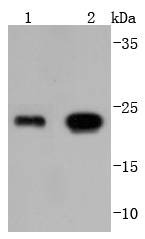 Anti-GPX1 Antibody (2F994)