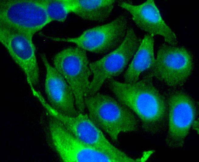 Anti-GSK3B Antibody (1A830)