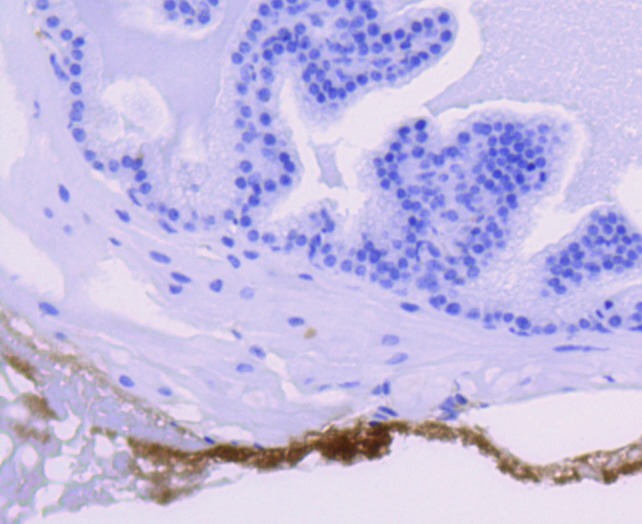Anti-GYS1 Antibody (7U169)