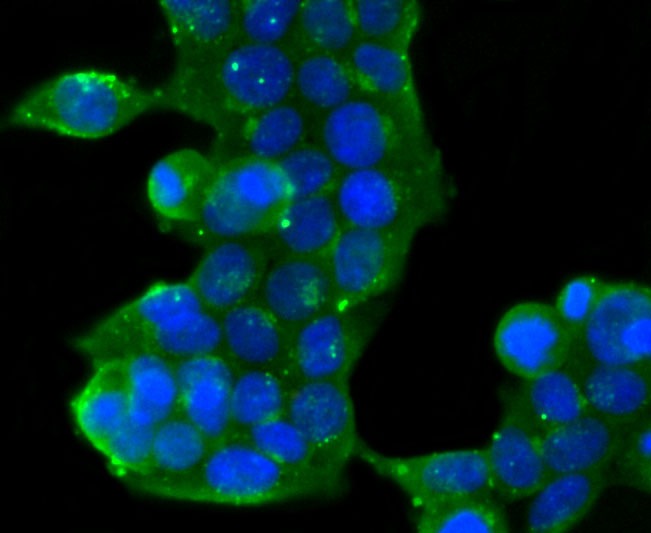 Anti-GOLM1 Antibody (8V618)