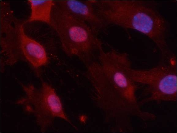 Anti-Phospho-GSK3A/B (Tyr279, 216) Polyclonal Antibody