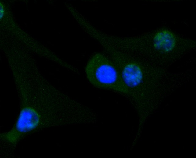 Anti-GYS1 Antibody (7U169)