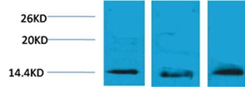 Anti-Tri-methyl-Histone H2B type 1-B (Lys5) Polyclonal Antibody