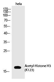 Anti-Acetyl-Histone H3 (Lys123) Polyclonal Antibody