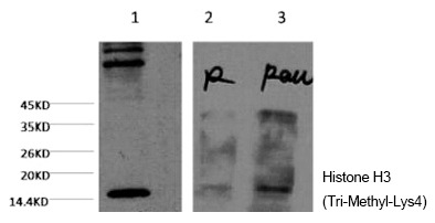 Anti-Tri-methyl-HIST1H3A (Lys4) Antibody (5G654)
