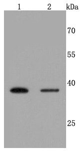 Anti-Haptoglobin Antibody (8N175)