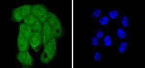 Anti-Histone H2B type 1-K Antibody (4Z139)