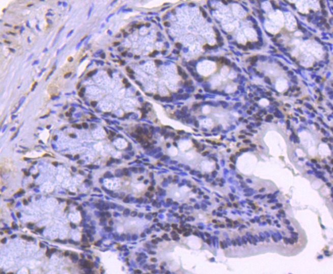Anti-Acetyl-Histone H2B type 1-K (Lys20) Antibody (5U443)
