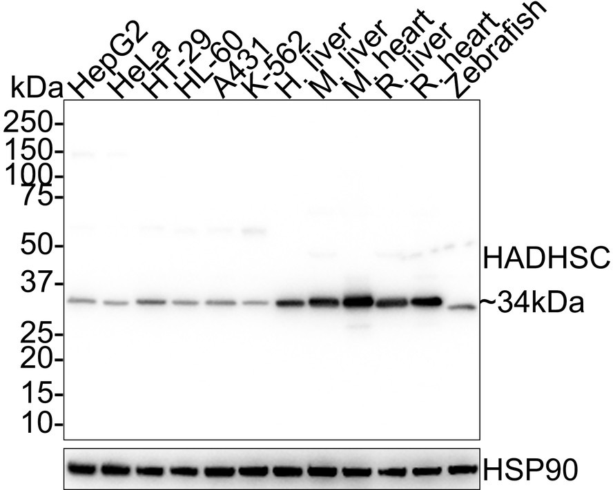Anti-HADHSC Antibody (1K241)