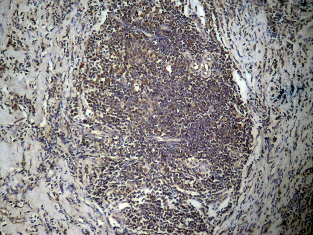Anti-Di-methyl-HIST1H3A (Lys27) Polyclonal Antibody