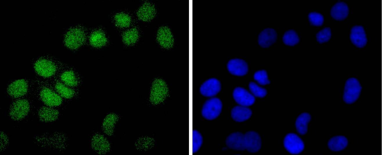 Anti-Mono-methyl-Histone H2B type 1-K (Arg79) Antibody (5Q957)